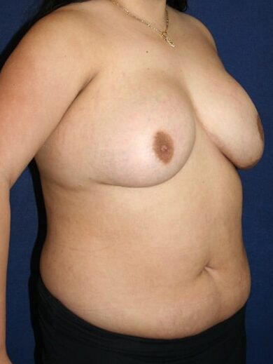 After Image